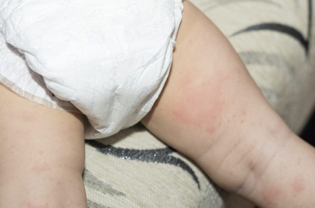 bercak merah popok bayi, kristal urat bayi, tanda ISK bayi, Bunda, si Kecil
